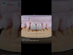 Faisceau de dentition EMAX pressé naturel 16 nuances