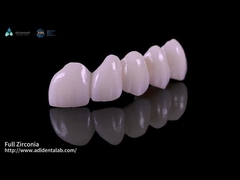 Haute translucideur de plein contour Zirconia Bridge Résistance aux fissures Esthétique naturelle