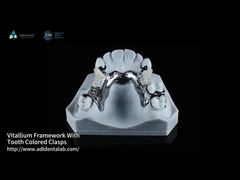 Cadre FDA Vitallium avec des claviers de couleur dentaire pour l'esthétique naturelle