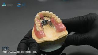 Qualité de soudure de précision de couronne de télescope