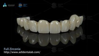 Solutions d'externalisation de laboratoire dentaire en zircone haut de gamme