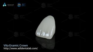 Explication des couronnes dentaires hybrides en céramique Vita Enamic