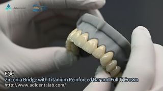 Restaurations avancées en zircone en laboratoire dentaire
