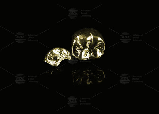 acheter Alliage précieux or jaune 60% couronne métallique complète couronne métallique complète fabrication en ligne