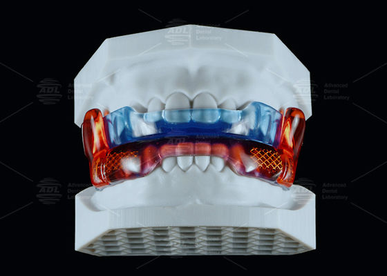 acheter Appareil anti-ronflement en silicone de qualité médicale pour améliorer le sommeil fabrication en ligne