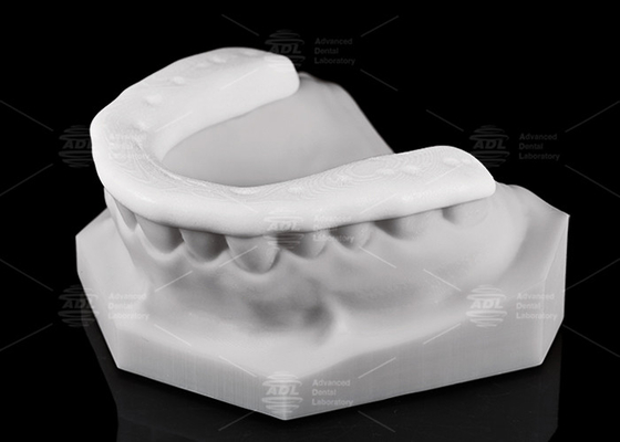 acheter Durabilité et respirabilité 3D imprimé Nylon Occlusal Splint / Garde de nuit pour les modes de vie actifs fabrication en ligne