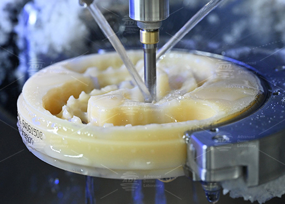 acheter Découvrez le pouvoir d'une prothèse complète esthétique et naturelle pour des sourires parfaits fabrication en ligne