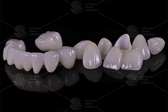 acheter La porcelaine du laboratoire dentaire chinois fusionnée avec du zirconium haute résistance fournissant des services sur mesure au laboratoire dentaire international et dentiste fabrication en ligne