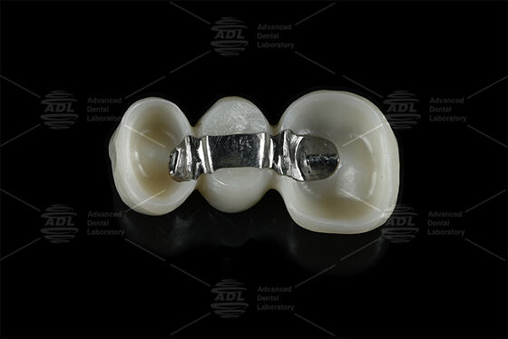 acheter Barre de titane de renforcement personnalisable combinée avec du zirconium frais qui fournit des solutions de cadre d'implant dentaire fabrication en ligne