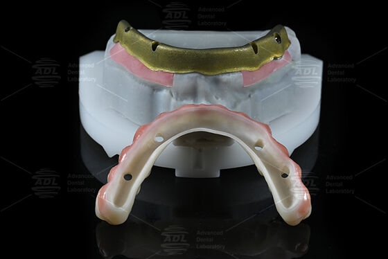 acheter Laboratoire dentaire chinois Compatible avec la plupart des systèmes d'implants dentaires Tous sur 4 Offre en 72 heures Temps de traitement et paramètres techniques fabrication en ligne