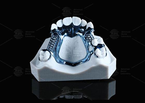 Cadre en titane imprimé 3D anodisé léger et adapté à la peau sensible