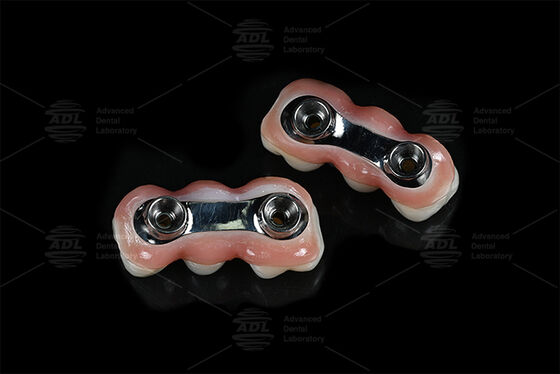 Barre d'implant de renforcement CAD CAM Conçue pour un ajustement de précision Compatible avec la plupart des systèmes d'implant dentaire Assurant des solutions de restauration dentaire Laboratoire dentaire chinois