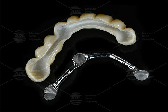 Barre de titane de renforcement personnalisable combinée avec du zirconium frais qui fournit des solutions de cadre d'implant dentaire